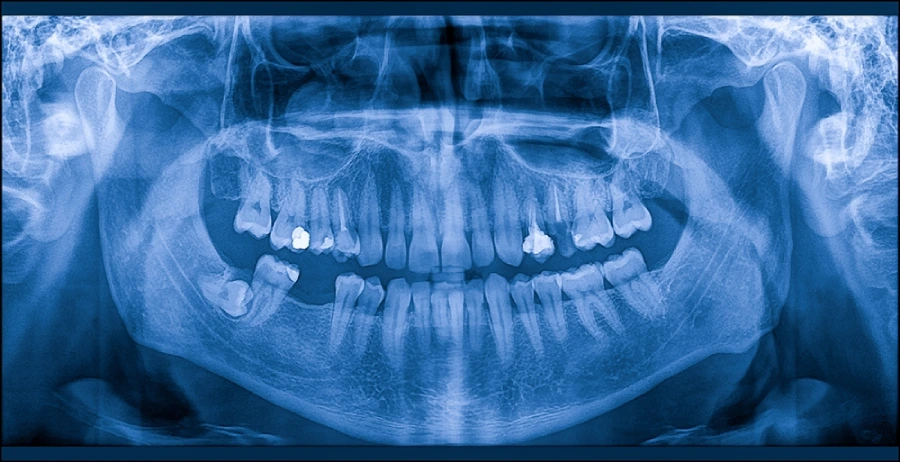 弁天町駅徒歩1分の歯医者、弁天町やまうち歯科の歯科ドック